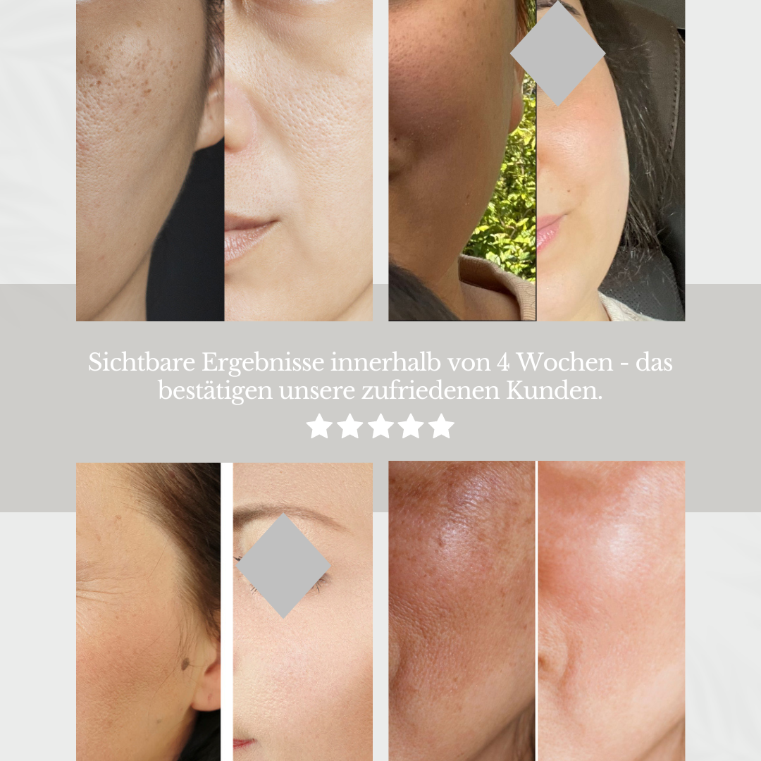 SEIDENBLÜTE - Whitening Cream